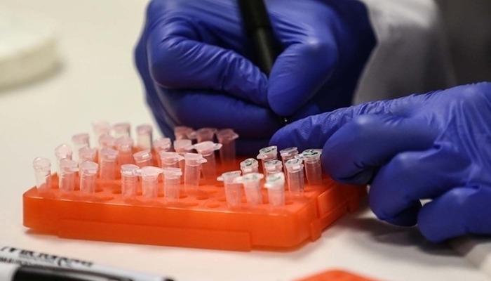 SON DAKİKA | Türkiye’de rastlandı mı? Kısıtlama gelecek mi? Sağlık Bakanlığı’ndan ‘M çiçeği (mpox) hastalığı’ açıklaması! DSÖ maymun çiçeği nedeniyle acil durum ilan etmişti